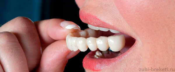 исправление неправильного прикуса зубными коронками