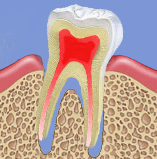 подвижность зубов