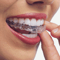 Выравнивание зубов каппами Invisalign